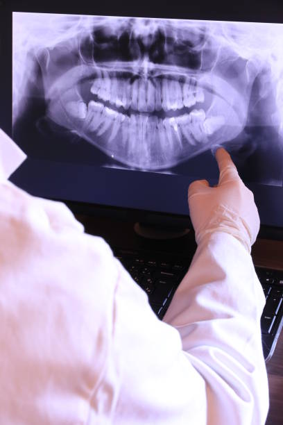Best Dentist for Tooth Abscess  in Broadway, VA